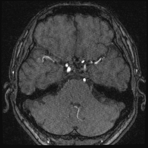 Click on the Serie image to view the images of VILLANUEVA, WILLIAM A.